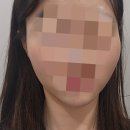 브이트라 후기 얼굴 브이라인 관리 이걸로 끝