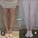 서초대로34길 23 | 오다리 교정 운동 효과 있나요? 실제 성공 사례로 알아보아요! (승무원 면접 오다리로 고민이라면 꼭...