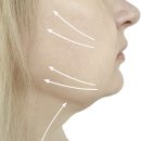 관문병원 | 대구 세르프 리프팅 후기 병원 해석법 원장은 이렇게 봅니다