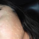 톡스앤필의원불당점 | 톡스앤필 스킨보톡스 후기:)