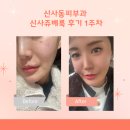 신사동-1 | 신사동피부과 신사쥬베룩 후기 1주차 !