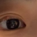 서울숲삼성안과의원 이미지