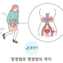 남성 방광암 ＜원인증상예방＞ 방광암 노출 위험 직업군 이미지