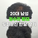 맨시크 | 의왕두피문신 20대 남성 탈모 유전자를 이겨내다 | 맨시크 SMP 후기
