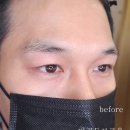 골든브로우 네이버블로그