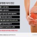 관절염 보스웰리아 효능 성분 효과 부작용 먹는방법 이미지