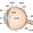 조치원한의원 : 시신경염에 대해서 알아볼까요? 이미지