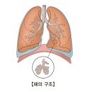 미만성 간질성 폐질환(Diffuse Interstitial lung disease) 이미지