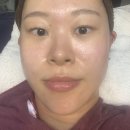 미가피부전문연구소 네이버블로그