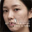 서울인젝터 | 여드름흉터 치료, 쥬베룩 시술 방법 비교 (손주사, 미라젯, 포텐자, 인젝터)