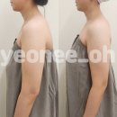 르벨로 스킨 | 결혼하기 전에 받을걸 후회한 웨딩케어 송도 르벨로스킨 라운드 숄더 관리 후기(주차/소요시간)