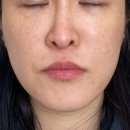 한달음한의원 이미지