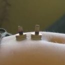 동생한의원 이미지