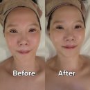 지에스25 나운청솔점 | 미금역에스테틱 듀에스떼에서 받은 변화 피부윤기 , 윤곽 리프팅 동시에 리얼 찐후기