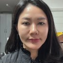 압구정 동안시술 에이포의원 팔자필러 마리오네트필러 후기