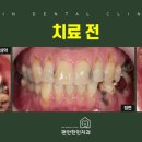 편안한민치과 이미지