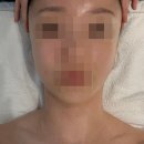 반포대로23길 45-15 | 반월당 제이스오유에스테틱 봉산동 윤곽관리 이중턱관리 후기