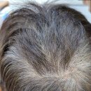 리아앤스칼프 이미지