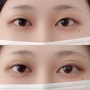 위치커피대구복현