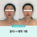 고운빛깔 해운대점 | [부산/해운대에스테틱] 고운빛깔 에스테틱 해운대점_온다웨이브 후기 #부산웨딩관리
