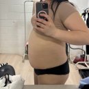 탄탄병원 | 복부지흡+팔지흡후기 인천지방흡입병원 내돈내산 (사진많음)