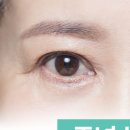 하라라성형외과의원 네이버블로그