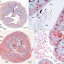 Ecytonucleospora hepatopenaei (EHP)에 감염되는 새우의 조직과 세포 이미지