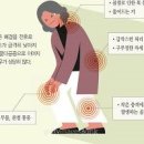 골다공증 검사 수치 증상에 좋은 음식 이미지