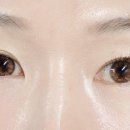 안경박사 위드렌즈 이미지