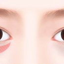 눈꽃피부과의원 이미지