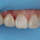 네츄럴치과기공소 이미지