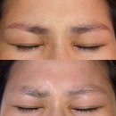 마산1 | 창원 붉은 눈썹문신제거 잔흔제거 "제시뷰티 마산" 후기(1~3회차)