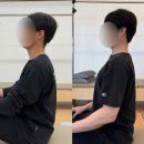 (주)레이델코리아 롯데백화점 광복점 | 후종인대골화증, 손에 힘 빠지는 느낌(거북목 교정운동과 스트레칭)