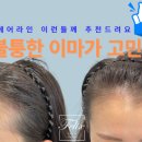 헤어라인 이미지