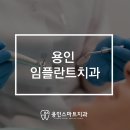 용인임플란트치과 추천! 치아손상 복원, 정확한 진단부터 꼼꼼한 시술까지