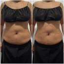 등촌한의원 | 일산다이어트한의원 없이 건강하게 감량 후기