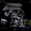 제일미즈여성의원 | [임신 22~24주] 유성미즈제일여성병원 정밀초음파 후기(+대전 을지대병원 정밀초음파)