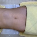 밸라뷰티샵 | 홍대복부관리 일로왁싱 홍대점 아로마 밸리테라피 뱃살 슬리밍관리 후기