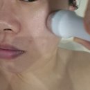 제니프 | [용산피부관리] 제니프 에스테틱 리프팅 윤곽 페이스 솔직후기