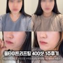 더400 | 강남 올타이트리프팅 솔직 후기 400샷 + 더엘주사 내돈내산 솔직 리뷰