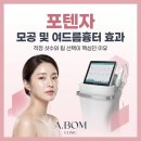 새로운 봄 의원 | 포텐자 모공 및 여드름흉터 효과, 적정 샷수와 팁 선택이 핵심인 이유