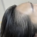 빈 헤어라인