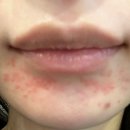 강남우태하피부과의원 이미지