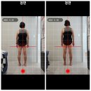 더나은공간 | 요추통증 고관절통증 잡는 일산체형교정 더나은체형교정원 후기