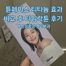 타임 | 튠페이스 티타늄 효과 비교 후 타임락튠 후기!