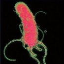 헬리코박터 파일로리 감염증 (helicobacter pylori infection) 이미지