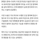 3D프린팅으로 제작한 맞춤형 인공 발목뼈 이식수술 성공 이미지