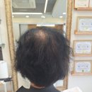 프라임가발헤어 | 대구 달서구 정수리가발 여성항암가발 인모 스타일링까지완벽하게