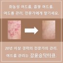 샵콕 | 김해 등드름 관리 잘하는곳 강윤승닥터큐 후기 모음