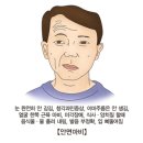 혼돈.몽상-'구안와사?/중풍?/침술?/쑥뜸?' '동양의학?' '백신의 덫-서양의학?' '운명?/신의뜻?' '식자우환/파식망상-시공간?' 이미지